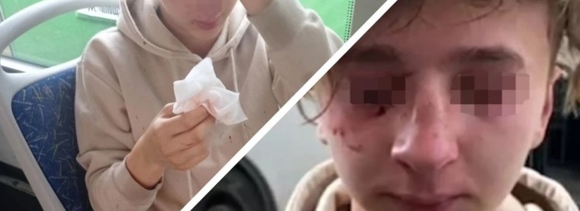 "Я тебе очки в лицо вобью, клоун!": Мужчина избил 15-летнего подростка в автобусе из-за внешности