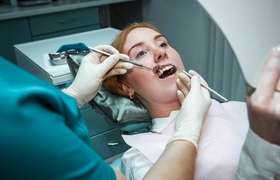 Вот откуда все ваши кариесы: челнинские стоматологи высказались 